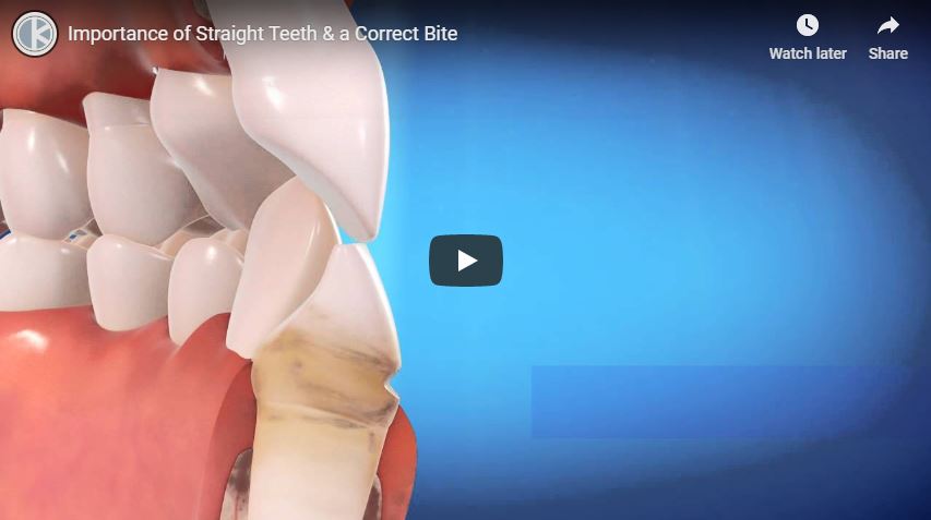 The Importance of Having Straight Teeth