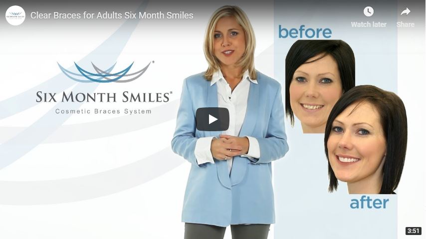 Six Month Smiles Video